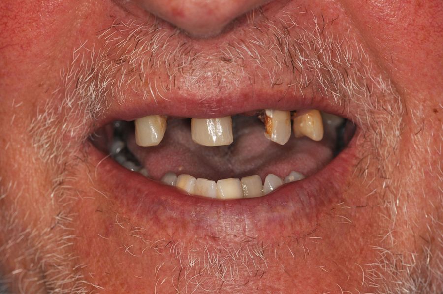 smile in a day 9 before